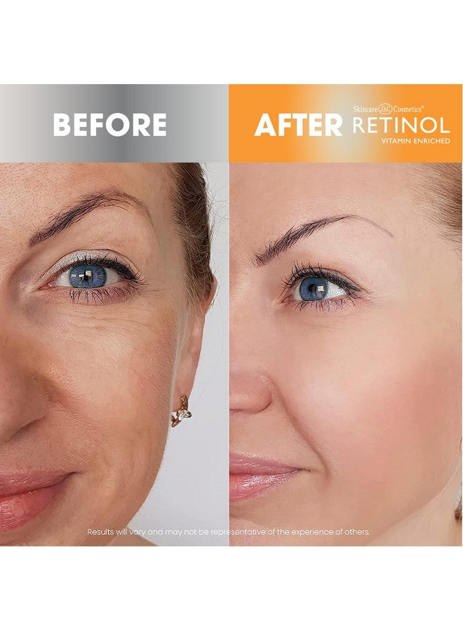 ريتينول + مرطب للوجه بفيتامين سي - Image 4