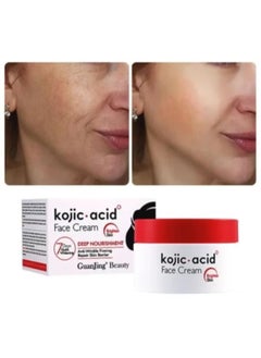 Guangjing Beauty Kojic Acid Face Cream - pzsku/ZEA8EBF78E4ED38FD715FZ/45/_/1740937604/d9912a85-657a-4b87-9e3c-0e30be78e55c