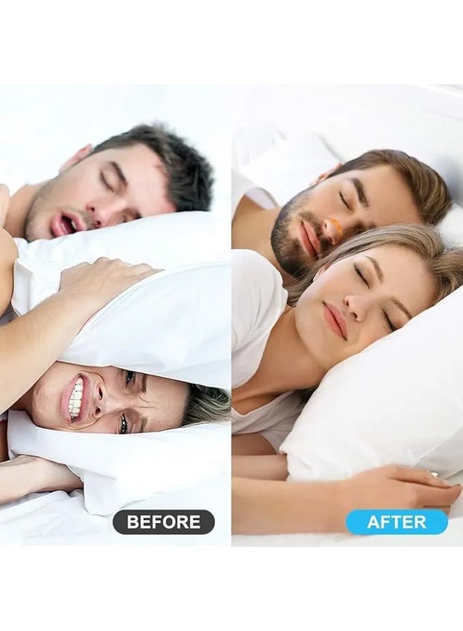 Snoring Stopper and Magnetic Nose Dilator for Deeper Sleep and Greater Daily Activity - 30 Pair - Image 1