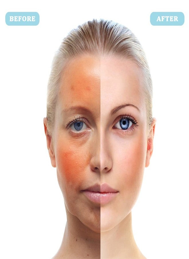 PrettyCare Ice Roller W+V shaped ice wheel Blue - Image 4