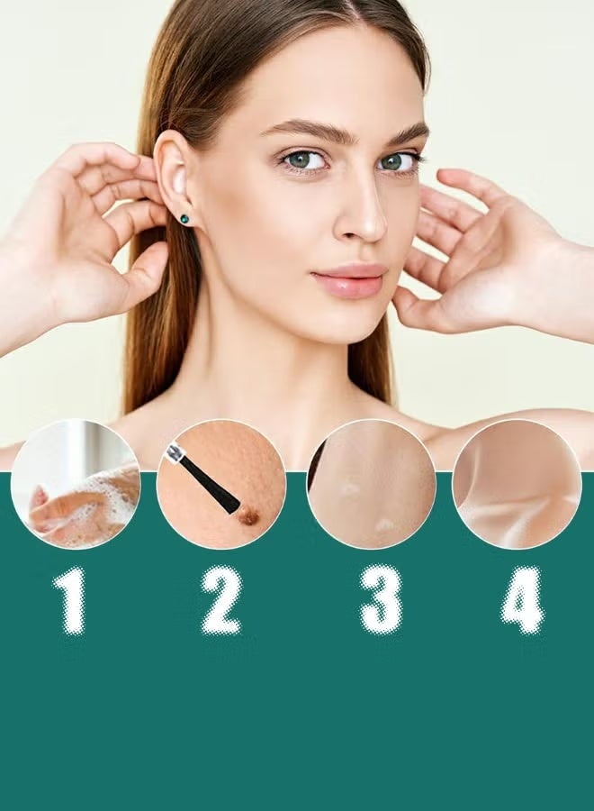  iBealee مزيل الثآليل والعلامات من iBeaLee - مستخلص طبيعي 100% (20 مل) - Image 2