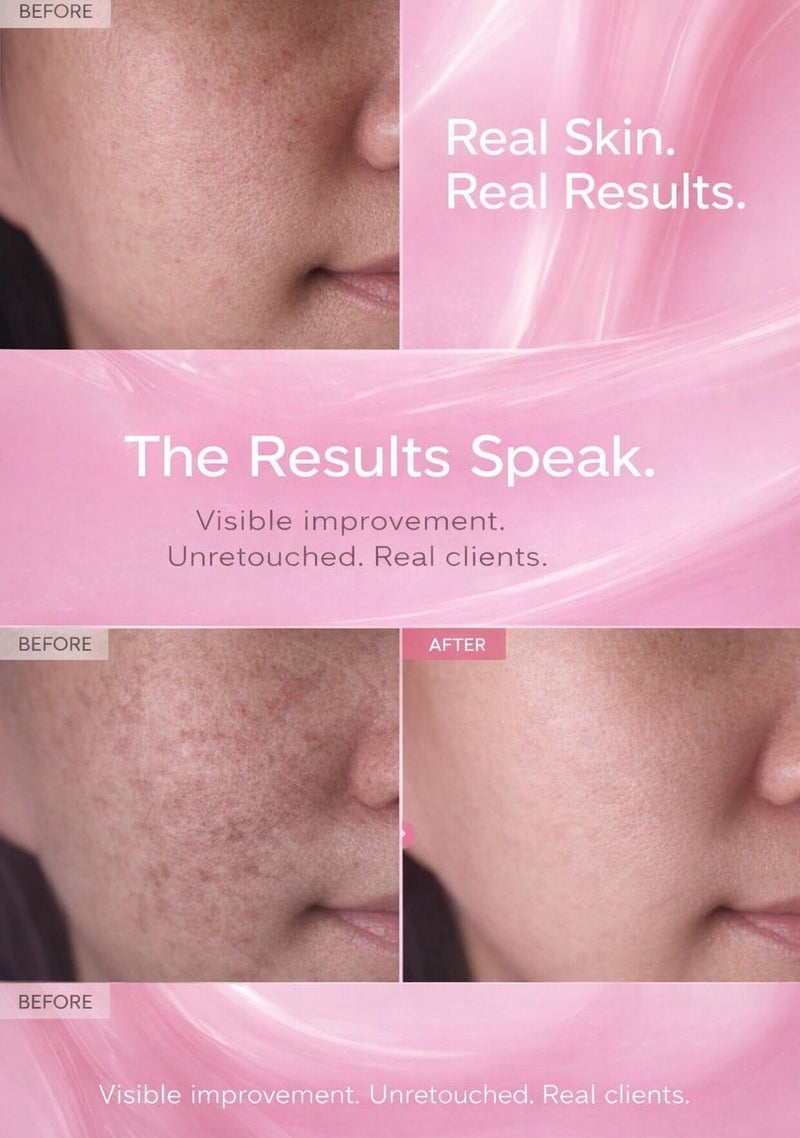 Carvenchy TXA Cream with Arbutin, Niacinamide & Hyaluronic Acid – Brightening Dark Spots, Hyperpigmentation, Uneven Skin Tone, Anti-Aging, Moisturizing & Radiance-Boosting Skincare for All Skin Types – 50ml - Image 2