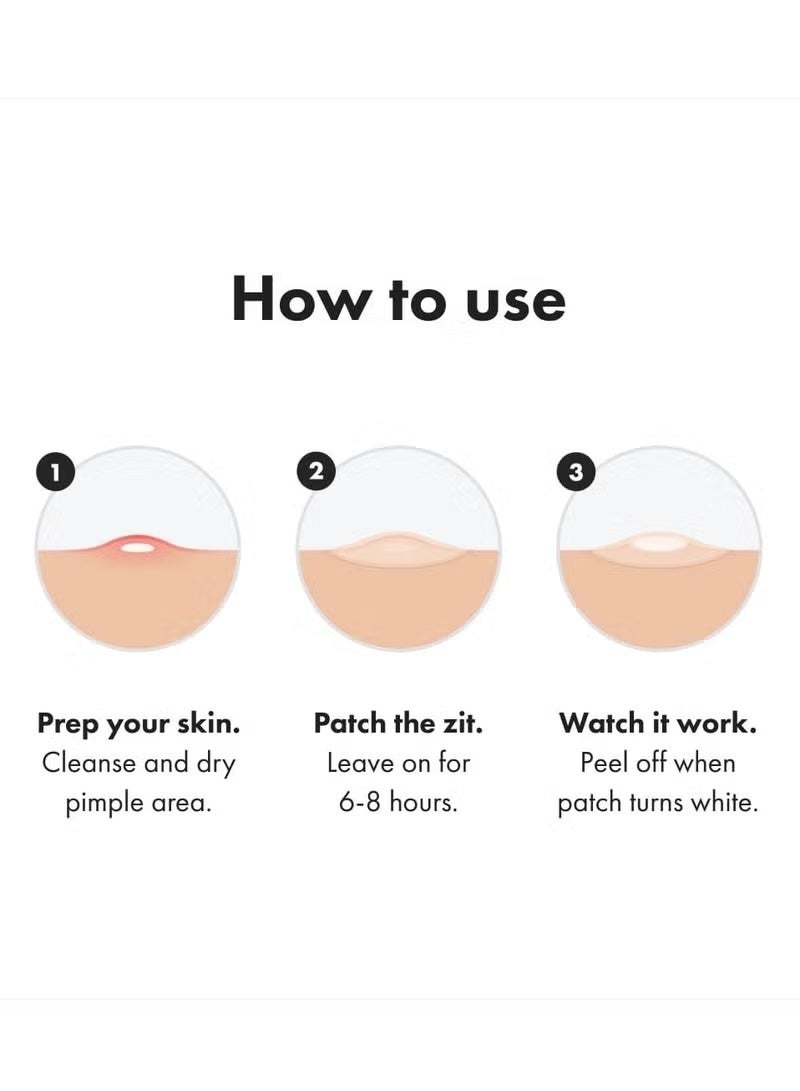 Mighty Patch 36-Piece Hydrocolloid Acne Absorbing Pimple Patch - Image 5