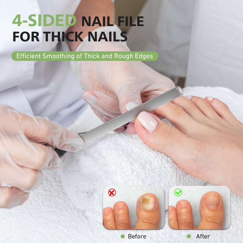 BALUCA Toenail File for Thick Nails & Ingrown Relief | Heavy Duty Metal Emery Board with Toenail Lifter for Seniors, Coarse Grit & Durable Stainless Steel Design (Black, 1.0, Count, 180/240 Grit) - Image 2
