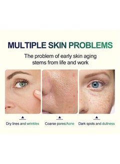 MOOYAM TCA 50% Peel Malic Acid & Citric Acid，Citric Acid Peeling Serum, Professional Chemical Peel for Face, TCA 50% Peeling Solution, Chemical Exfolianting Facial Peel for Dark Skin, Dark Spots, Acne, Wrinkle  - Image 5