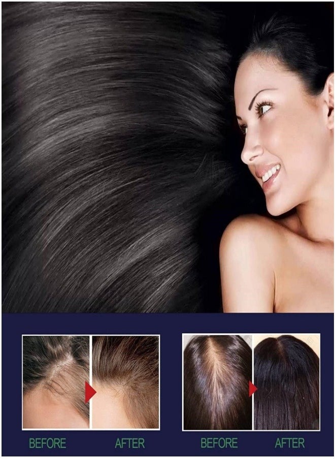 EELHOE - Tian Organic Nourishing Hair Care Regenerating Oil Spray Anti Hair Loss Treatment Hair Growth Essence Suitable for Men and Women - Image 1