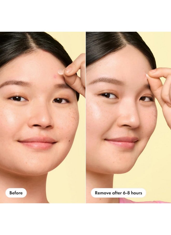Hero Cosmetics Hero Cosmetics Mighty Patch™ Mini Invisible+ Patches - Extra Small Daytime Hydrocolloid Acne Pimple Patches for Covering Zits and Blemishes, Blends Into Skin and Barely There (30ct 10mm Patches)  - Image 5