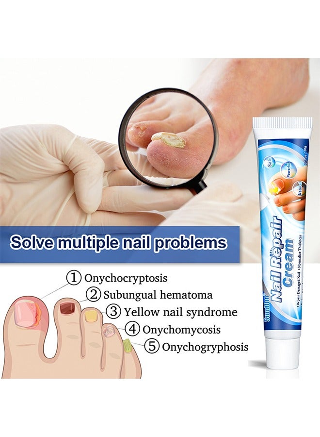 سوميفون كريم العناية بالقدم, كريم القدم برائحة القدم للرياضيين, كريم مضاد للفطريات, كريم مضاد للبكتيريا لقدم الرياضيين, علاج التعقيم إصلاح العناية بالقدم المضادة للعدوى 20 جرام - Image 5