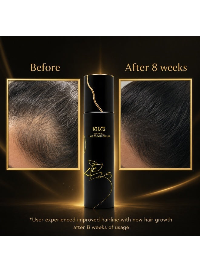 Roze Botonical Hair Growth Serum | Stops Hair Fall | Boost New Hair Growth | Guaranteed results from 30 days | 500ml - Image 4