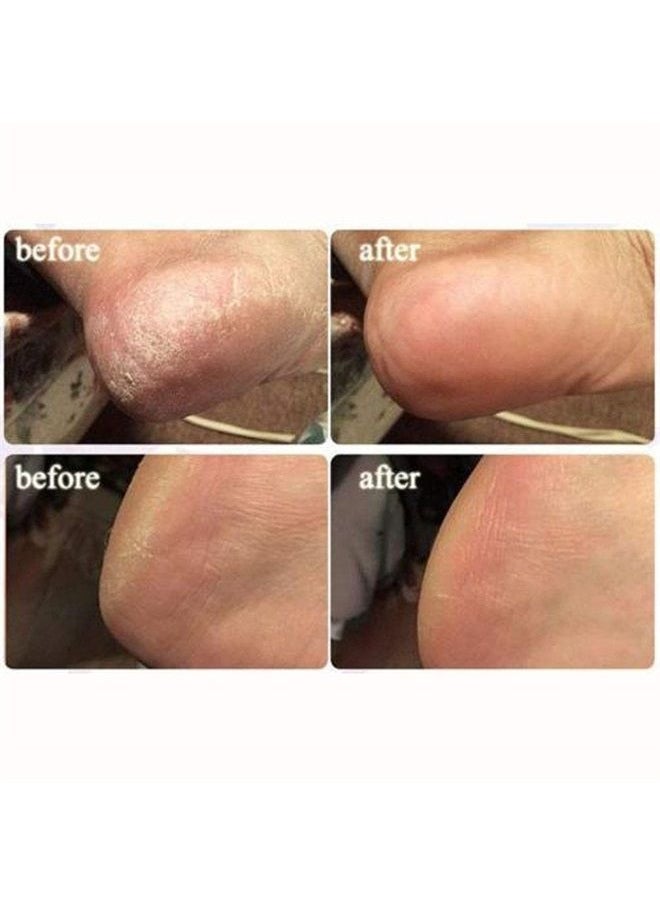 10Pcs Ginger Foot & Hand Salts & Soaks Foot Care,Eliminate Fatigue Improve Sleeping Foot Pain Foot Care Treatment
