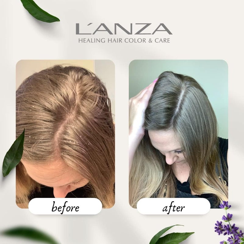 LANZA L'ANZA Healing Remedy Scalp Balancing Cleanser, Restores Wellness to Hair and Scalp While Reducing Oiliness and Excessive Sebum, with Papaya Extract, Paraben-free, Gluten-free (9 Fl Oz) - Image 2