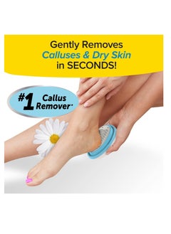 PedEgg PedEgg Classic Callus Remover, As Seen On TV, New Look, Safely and Painlessly Remove Tough Calluses & Dry Skin to Reveal Smooth Soft Feet, 135 Precision Micro-Blades, Traps Shavings Mess-Free  - Image 2