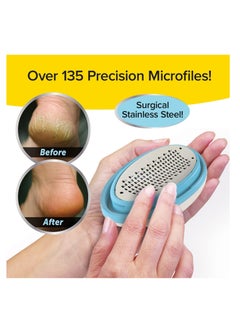 PedEgg PedEgg Classic Callus Remover, As Seen On TV, New Look, Safely and Painlessly Remove Tough Calluses & Dry Skin to Reveal Smooth Soft Feet, 135 Precision Micro-Blades, Traps Shavings Mess-Free  - Image 4