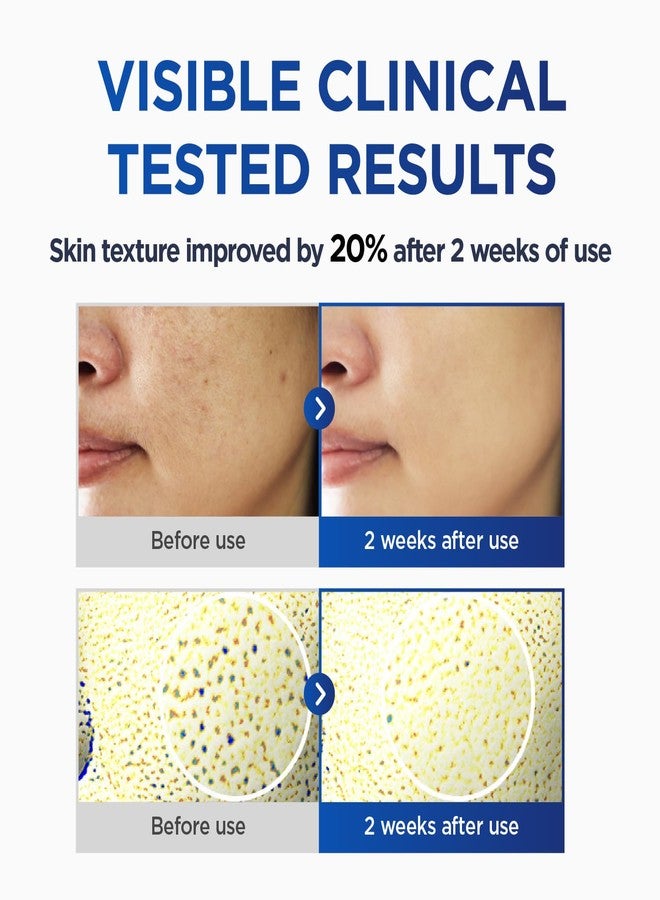 CKD Guaranteed CKD Vita C Teca Toning Shot Serum - Face Serum for Even Skin Tone, Reduces Discoloration, Dark Spots, and Pore Appearance, Vitamin C + Teca, Korean Skincare for Glowing Skin, 1.01 fl oz - Image 4