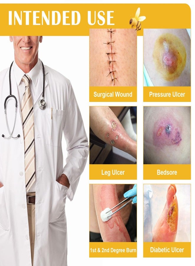 Ceeport Honey Gauze Wound Dressing, 4" x 4" Manuka Honey Wound Care, Medical Grade Honey Bandages for Wound Care, Honey Patch for Faster Healing from Burns, Abrasions, Cuts and Scalds (Pack of 10) - Image 5