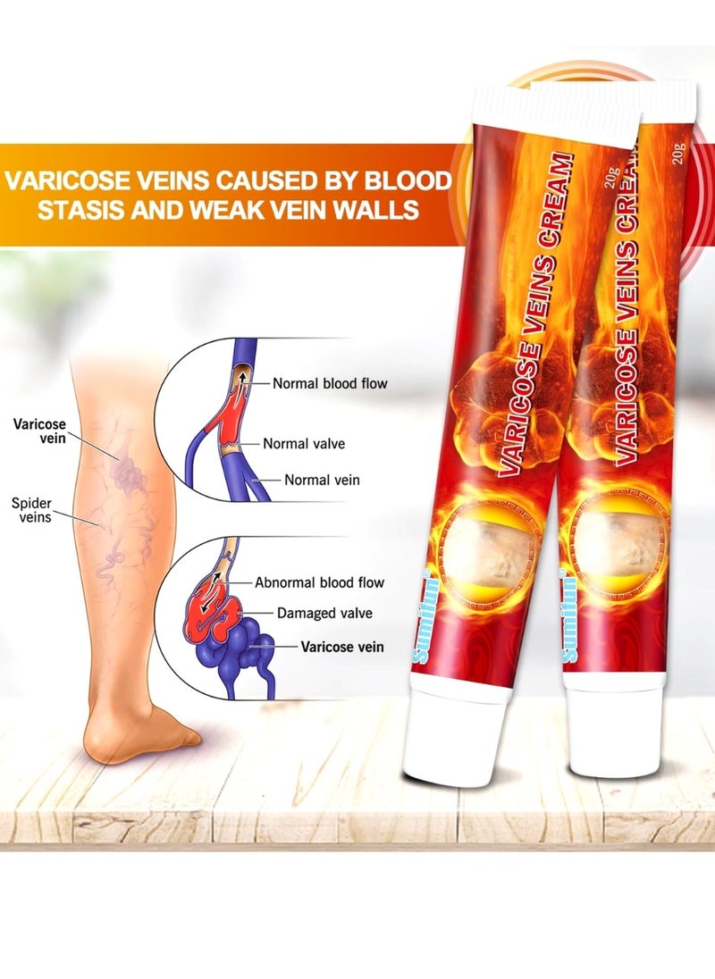 Varicose Veins Cream Improve Spider Veins and Blood Circulation Eliminate the Appearance of Varicose Veins Vein Inflammation Treatment Relieve Swelling and Pain Spider Veins Treatment Cream 20g