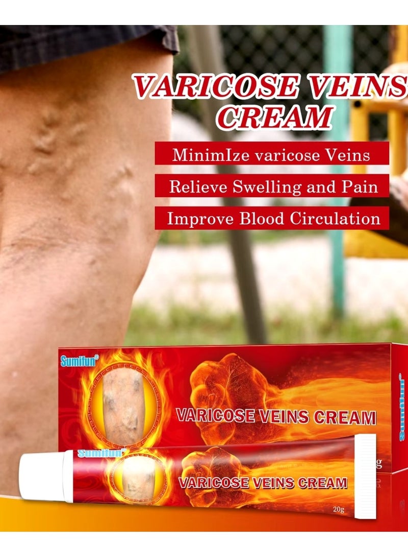 Varicose Veins Cream Improve Spider Veins and Blood Circulation Eliminate the Appearance of Varicose Veins Vein Inflammation Treatment Relieve Swelling and Pain Spider Veins Treatment Cream 20g