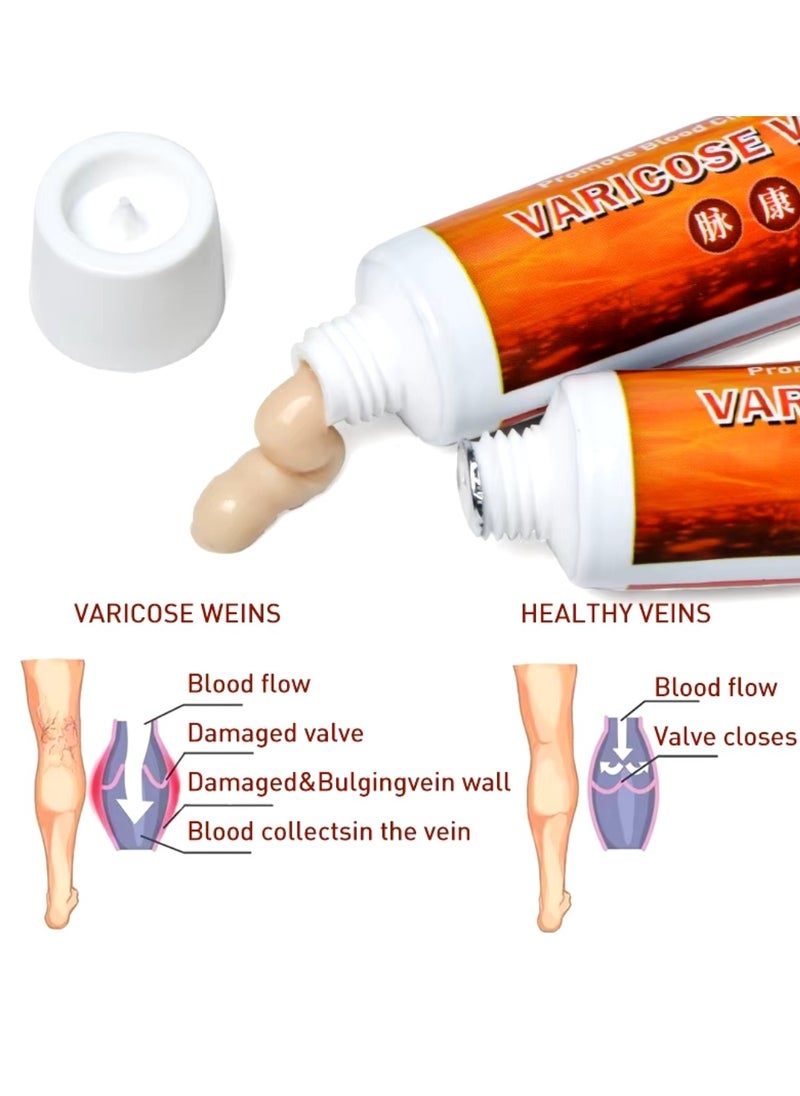 Varicose Veins Cream Improve Spider Veins and Blood Circulation Eliminate the Appearance of Varicose Veins Vein Inflammation Treatment Relieve Swelling and Pain Spider Veins Treatment Cream 20g