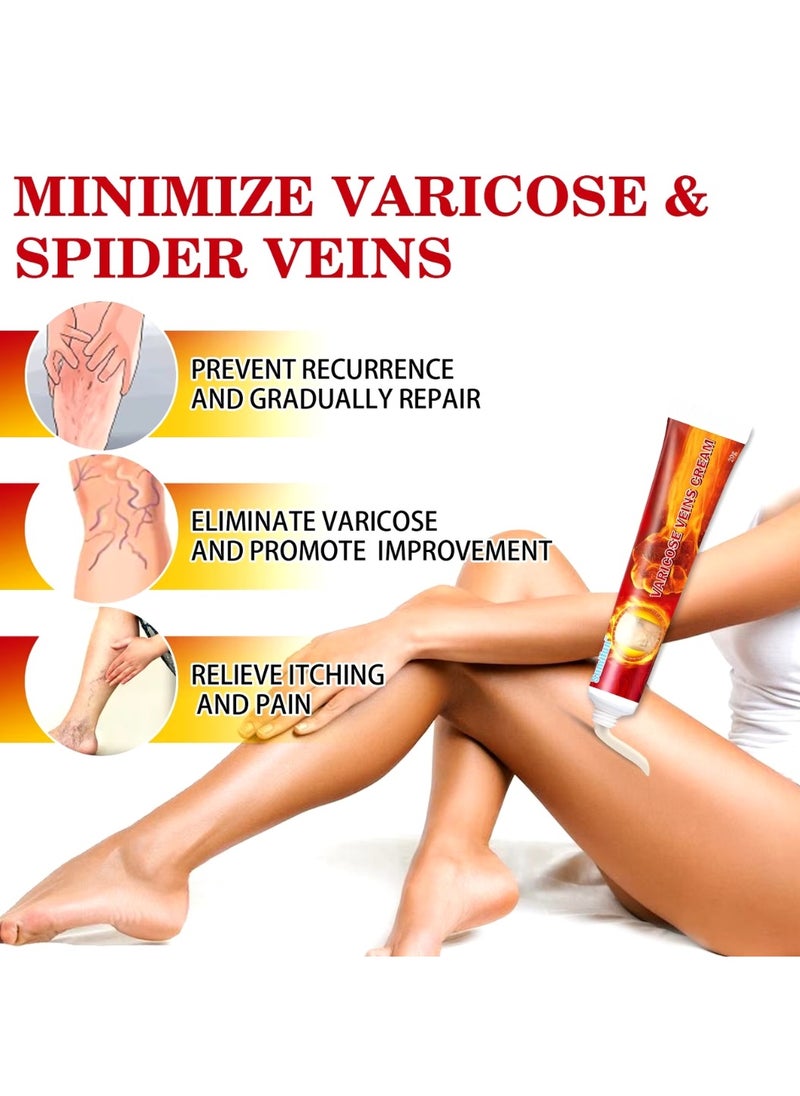 Varicose Veins Cream Improve Spider Veins and Blood Circulation Eliminate the Appearance of Varicose Veins Vein Inflammation Treatment Relieve Swelling and Pain Spider Veins Treatment Cream 20g