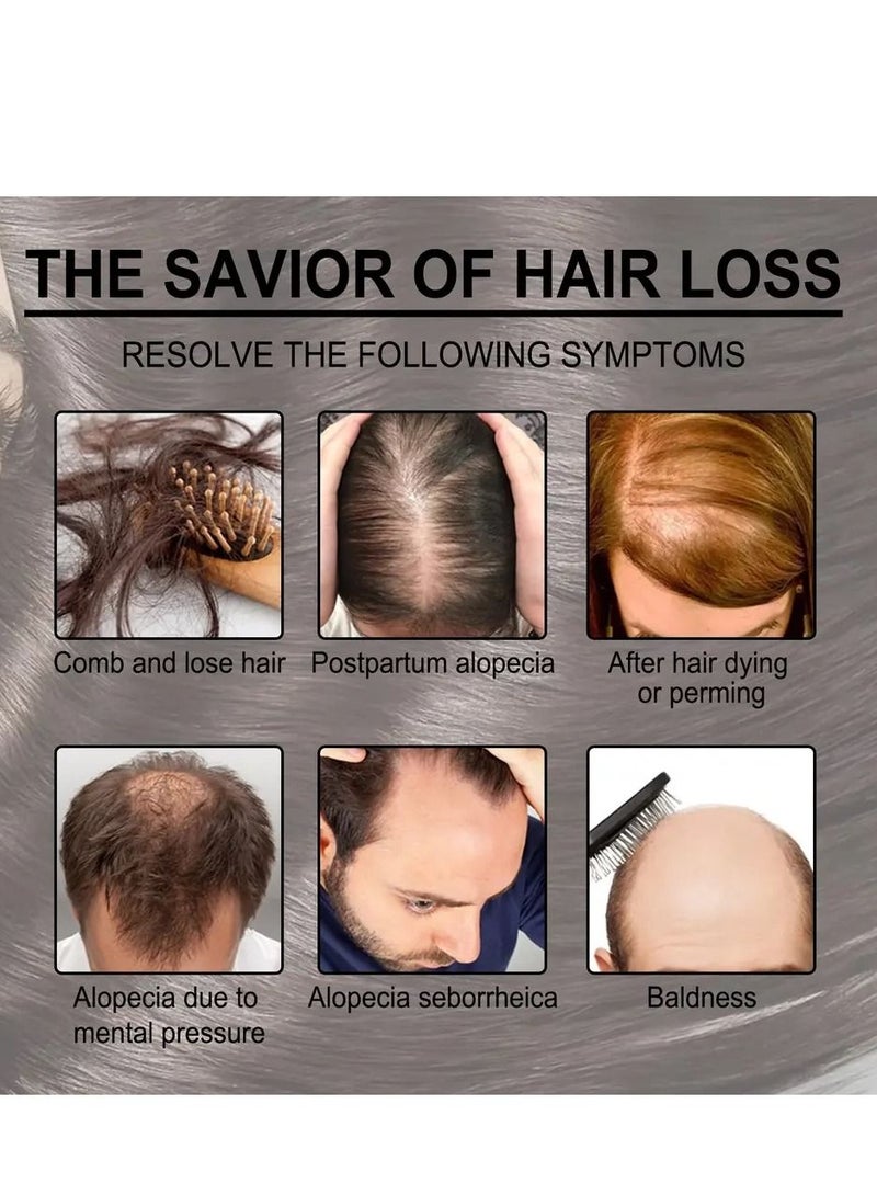 إيلهو زيت إكليل الجبل الأساسي لنمو الشعر ، يغذي ويصلح الأطراف المتقصفة. .زيت للعناية بالشعر, يعالج الحكة وجفاف فروة الرأس 30 مل - Image 5