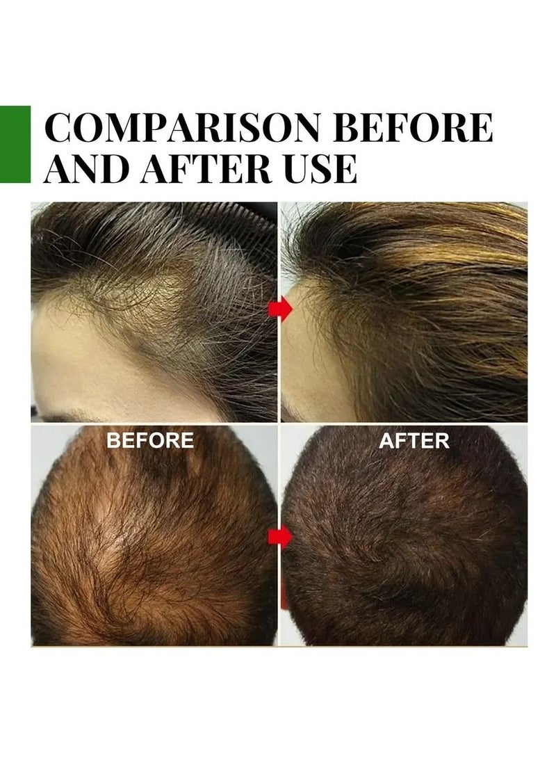 إيلهو زيت إكليل الجبل الأساسي لنمو الشعر ، يغذي ويصلح الأطراف المتقصفة. .زيت للعناية بالشعر, يعالج الحكة وجفاف فروة الرأس 30 مل - Image 4