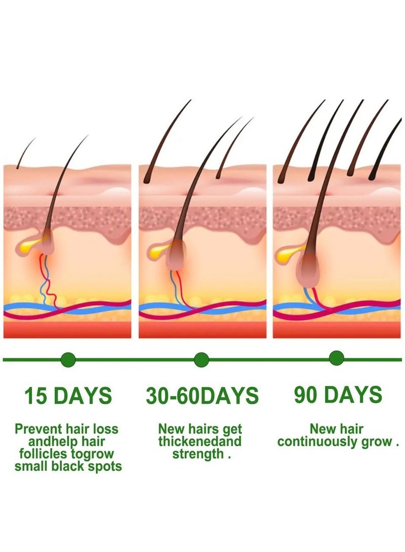 إيلهو زيت إكليل الجبل الأساسي لنمو الشعر ، يغذي ويصلح الأطراف المتقصفة. .زيت للعناية بالشعر, يعالج الحكة وجفاف فروة الرأس 30 مل - Image 3