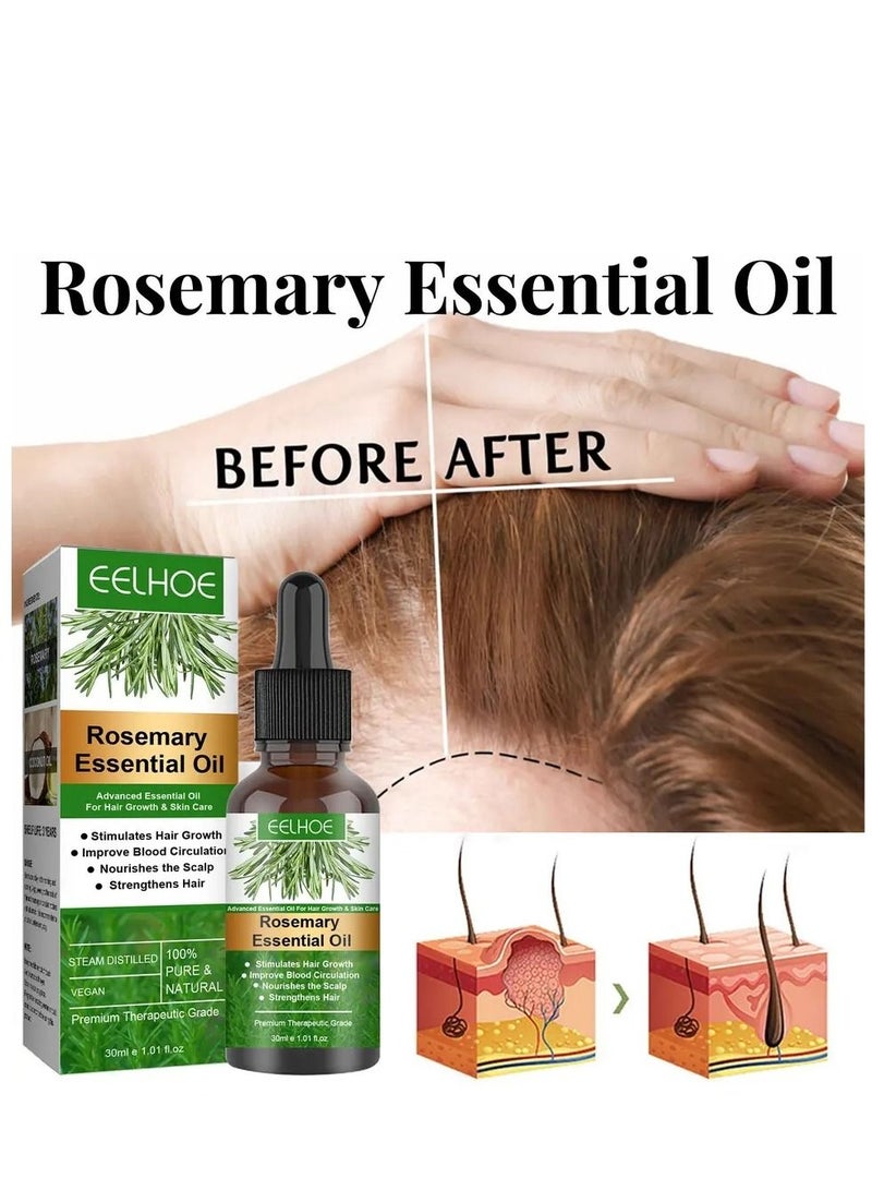إيلهو زيت إكليل الجبل الأساسي لنمو الشعر ، يغذي ويصلح الأطراف المتقصفة. .زيت للعناية بالشعر, يعالج الحكة وجفاف فروة الرأس 30 مل - Image 2
