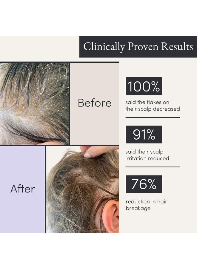 Jupiter Anti Dandruff Shampoo For Women & Men Physician Formulated For Flaky Itchy Oil Dry Scalp Treatment Vegan Sulfate Free Color Safe & Paraben Free Scalp Psoriasis Shampoo With Zinc - Image 5