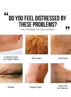 JoyPretty Scar Reducing Treatment, Intensive Repairing Scar Cream from Burns, Surgery 40g  - Image 2