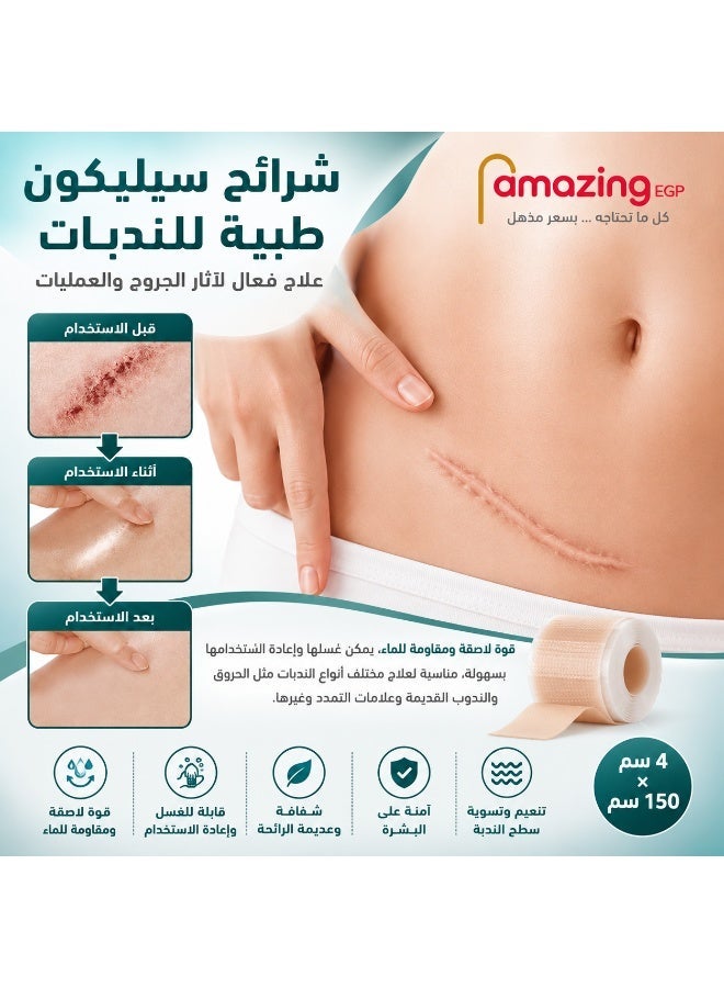 THE PACK | Silicone Scar Tape Roll Transparent 4 cm x 150 cm | Reusable & Washable, Cut to Size, Water Resistant, Daily Scar Care, Odourless Gel - Image 3