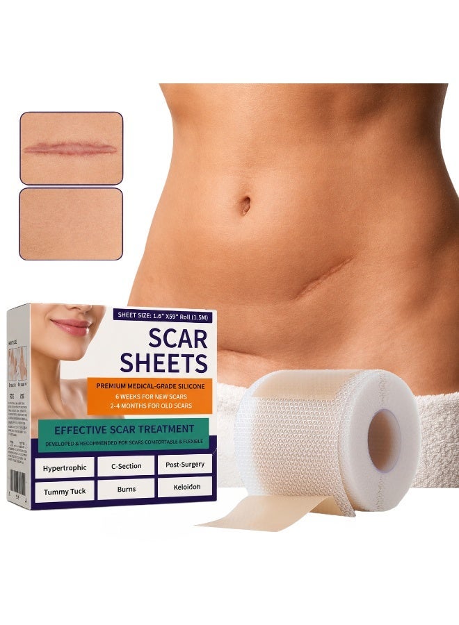 THE PACK | Silicone Scar Tape Roll Transparent 4 cm x 150 cm | Reusable & Washable, Cut to Size, Water Resistant, Daily Scar Care, Odourless Gel - Image 1