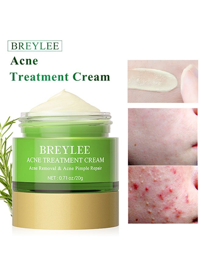 Breylee Acne Treatment Cream, Acne Removal and Acne Pimple Repair Cream, Natural Cystic Acne Treatment, Premium Acne Scar Cream And Pimple Remover 20g - Image 1