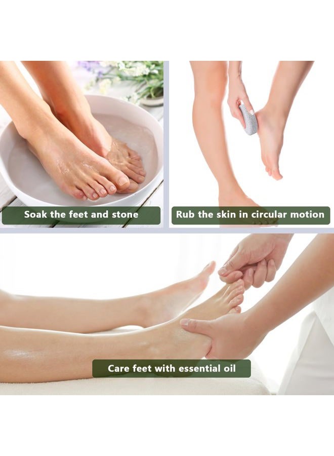 Borogo Natural Foot Pumice Stone for Feet, Borogo 2-Pack Lava Pedicure Tools Hard Skin Callus Remover for Feet and Hands - White&Red - Image 3
