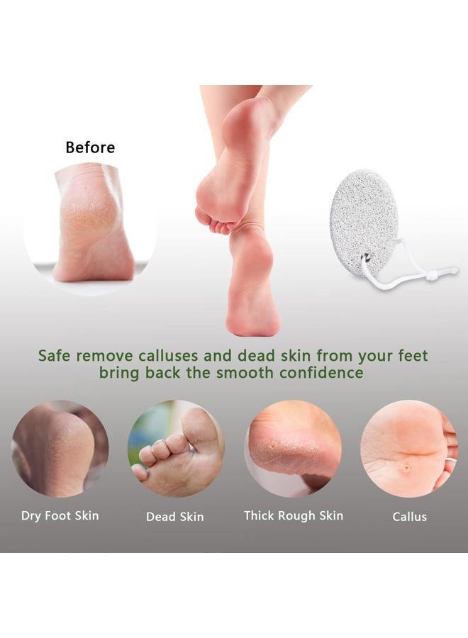 Borogo Natural Foot Pumice Stone for Feet, Borogo 2-Pack Lava Pedicure Tools Hard Skin Callus Remover for Feet and Hands - White&Red - Image 4