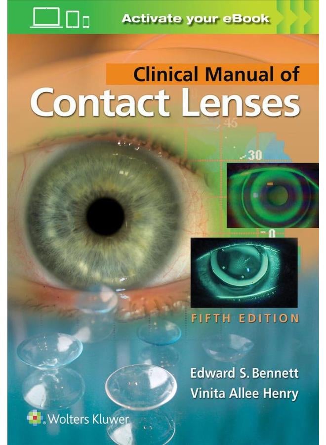 Clinical Manual of Contact Lenses Ed 5