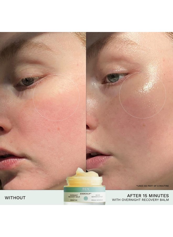 REN CLEAN SKINCARE REN Clean Skincare Nighttime Facial Moisturizer - Evercalm Overnight Recovery Balm for Face and Body Provides Skin Barrier Protection to Repair Rosacea, Redness and Irritation for Sensitive Skin  - Image 3