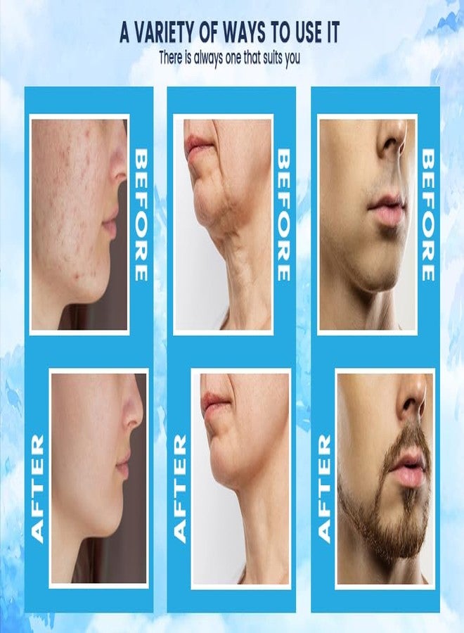 Gadget Hero's Microneedle Derma Stamp For Hair & Beard Regrowth, 0-3mm Ajustable 140A Titanium Microneedle, Facial Derma Stamp Kit For Face Skin Acne Repair, Hair Regeneration, Reusable Derma Pen. - Image 5