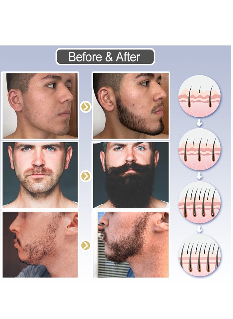 East Moon Beard Growth Fluid, For Beard More Full And Thick, Beard Growth Serum Of Plant Extraction, Pure Natural Promote Beard And Hair Growth  - Image 2