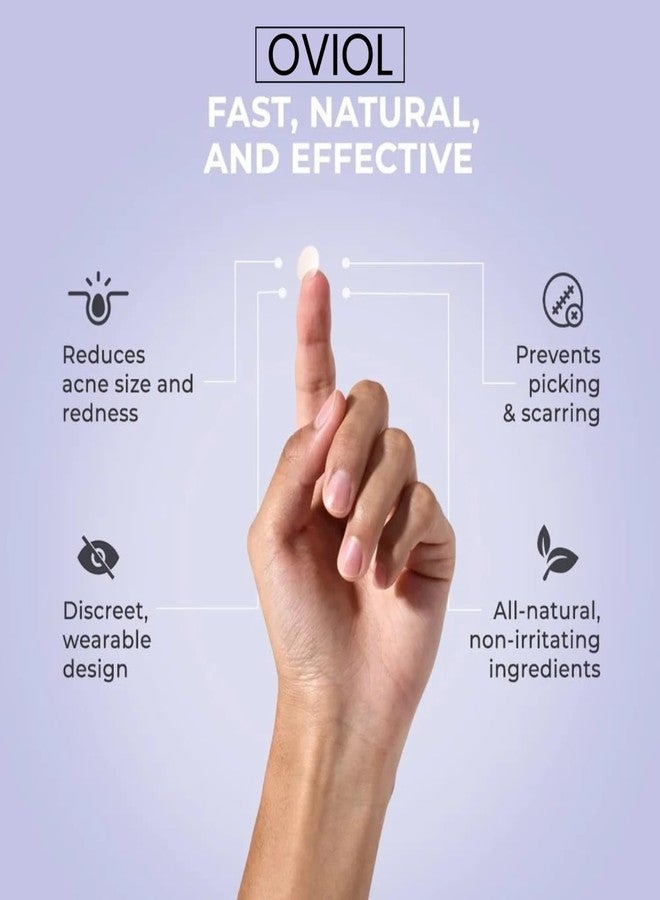 OVIOL Acne Pimple Patch for Face (72 dots) | Waterproof Patches for Active Acne | Absorbs Pimple Overnight and Reduces Excess Oil | Facial Patches with 100% Hydrocolloid (72 PATCHES) - Image 4