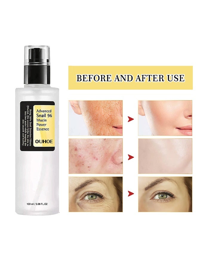 OUHOE Advanced Snail 96 Mucin Power Essence 100ml,Relpnish Skin Moisture,Reduce Wrinkles,Hydrating Serum for Dull & Damaged Skin,Sun Spots and Improves Skin Tone for Women and Men - Image 3