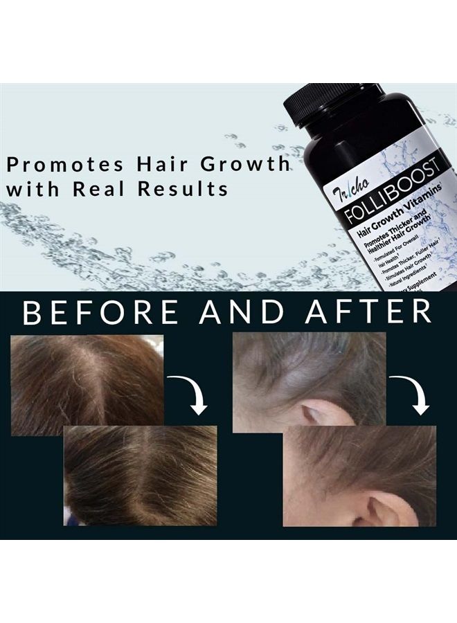 Folliboost Tricho Hair Growth Vitamins - with Biotin, Vitamin C, Zinc, and Vitamin B12 - Helps Promote Thick, Full Hair Growth - Natural-Based Hair Care Formula - Made in The USA(30-Day Supply)(1Pack)