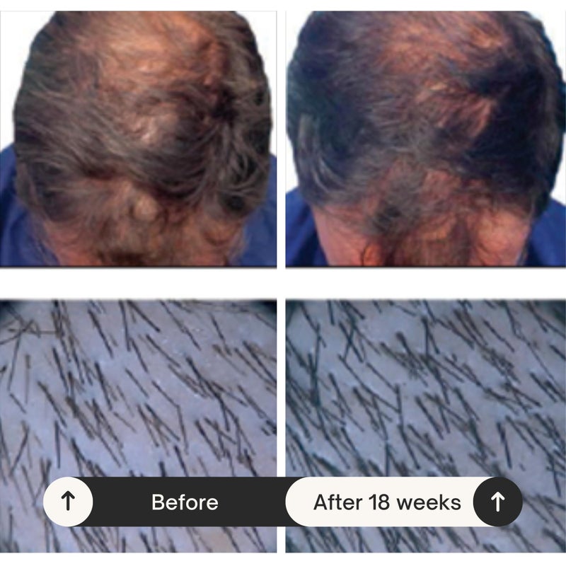 RAUSCH بلسم شطف الجينسنغ والكافيين من RAUSCH 200 مل - Image 4