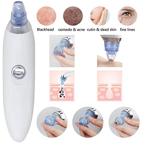 Adbeni 4 in 1 Multi-function Whitehead & Blackhead Remover Tool, |Acne Pimple Pore Cleaner Vacuum tools Facial Cleanser Device for Face, Nose & Skin Care, (White) - Image 2
