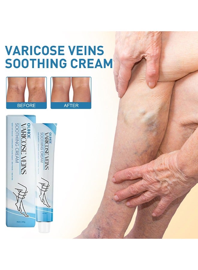 OUHOE Varicose Veins Soothing Cream, Soothing Leg Cream, Varicose and Spider Veins Treatment Cream, Improve Blood Circulation, Fast Relieve Swelling Pain 20g  - Image 1