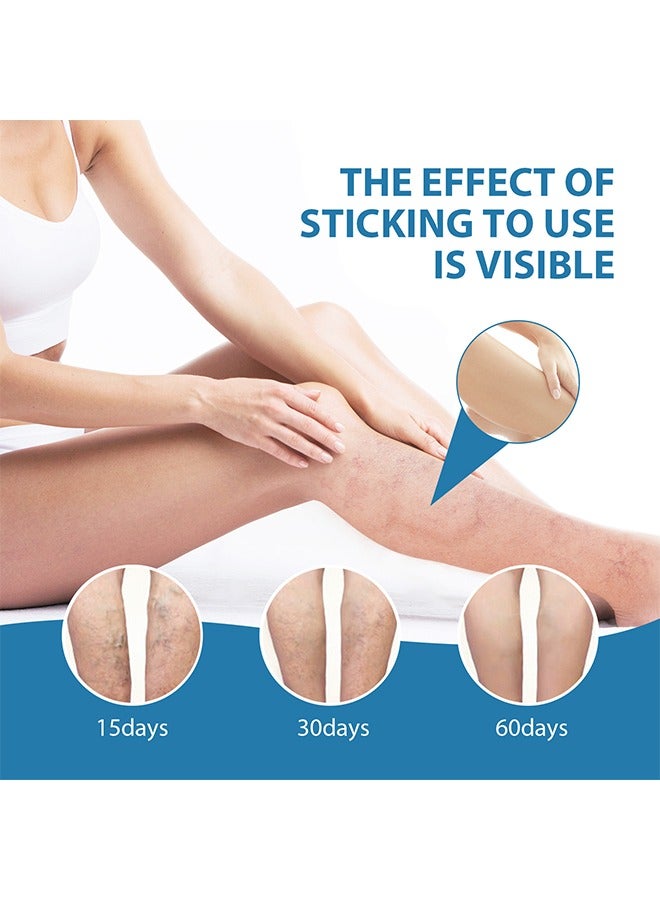 OUHOE Varicose Veins Soothing Cream, Soothing Leg Cream, Varicose and Spider Veins Treatment Cream, Improve Blood Circulation, Fast Relieve Swelling Pain 20g  - Image 4