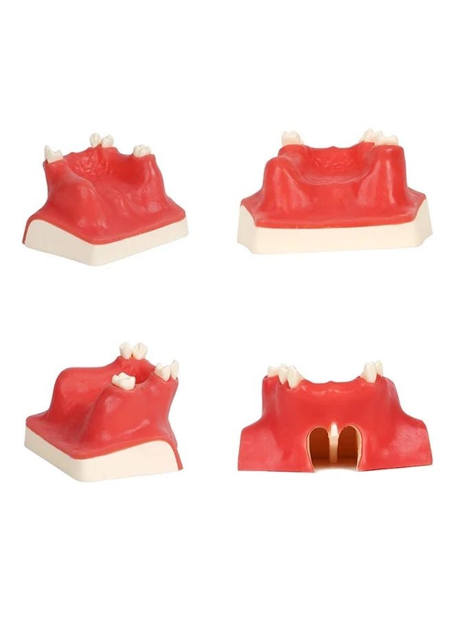 Dental Implant Practice Model Upper Jaw Sinus Lift Restoration Teeth 1Pcs Dentist Training - Image 5