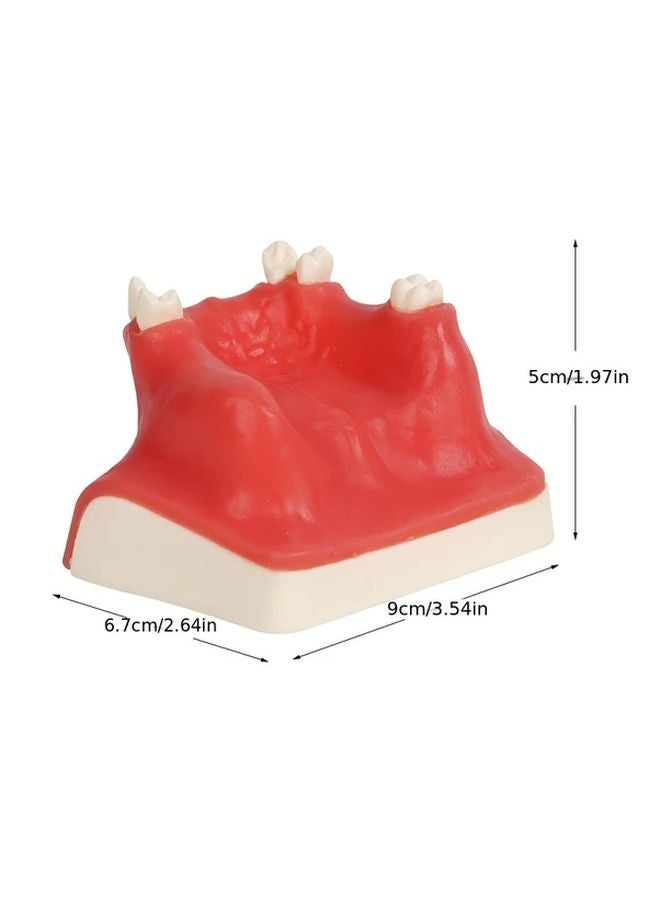 Dental Implant Practice Model Upper Jaw Sinus Lift Restoration Teeth 1Pcs Dentist Training - Image 3