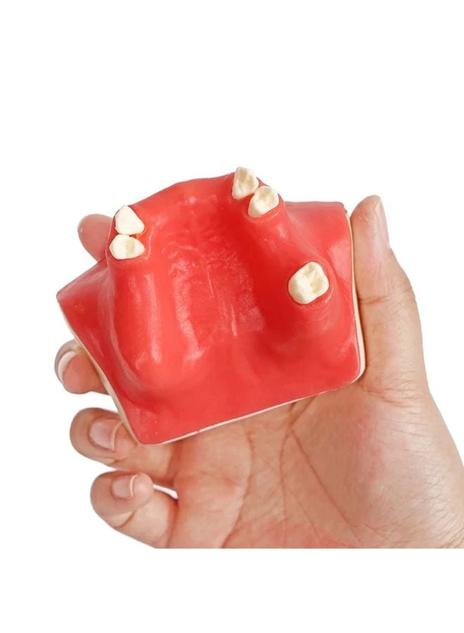 Dental Implant Practice Model Upper Jaw Sinus Lift Restoration Teeth 1Pcs Dentist Training - Image 4