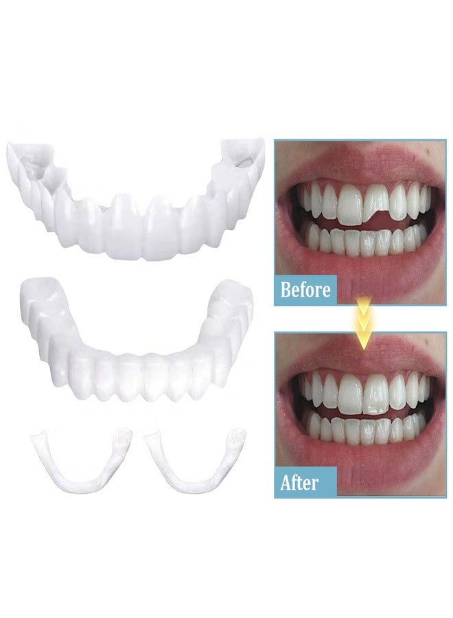 2 Pairs, Temporarily Adjustable for Men and Women, Regain Confidence Smile(White) - Image 4