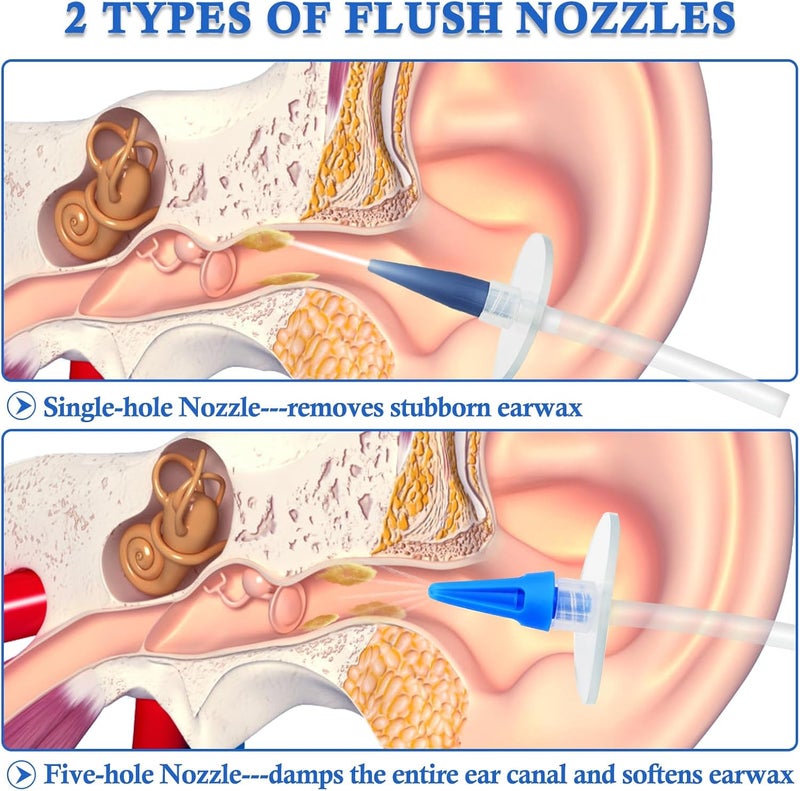 MOEBULB Ear Wax Removal Kit Earwax Removal Tools Manual Ear Irrigation Flushing System Ear Cleaner Safe  Effective Ear Cleaning Kit for Adults Kids  Elders Home Ear Washer No Doctors Visit Require - Image 4